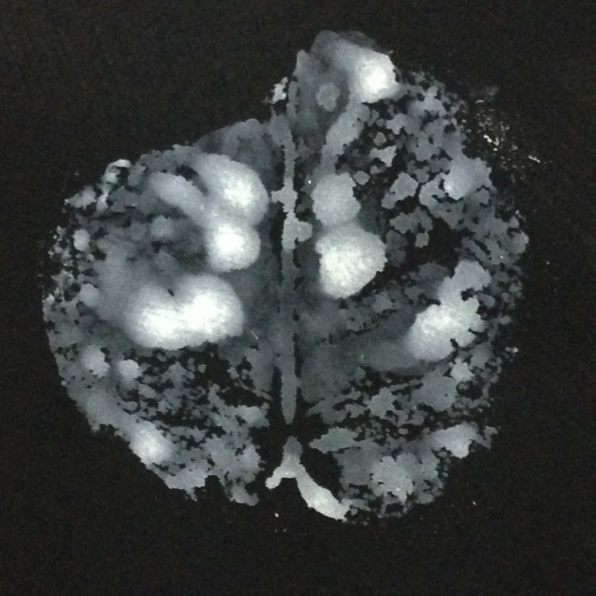 Leaf/Land/Lung #3