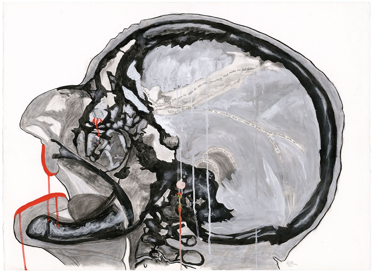 Lateral Skull